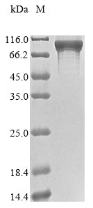 Greater than 85% as determined by SDS-PAGE.Recombinant Human Signal Recognition Particle Subunit Srp72 (SRP72) Protein (GST)