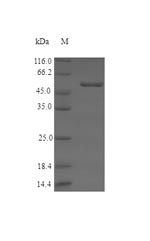 Greater than 90% as determined by SDS-PAGE.Recombinant Human Serine Racemase (SRR) Protein (His-SUMO)