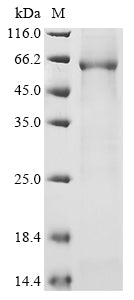Greater than 85% as determined by SDS-PAGE.Recombinant Human Serine Racemase (SRR) Protein (His-GST)