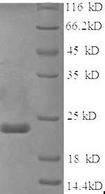Greater than 90% as determined by SDS-PAGE.Recombinant Mouse Sex-Determining Region Y Protein (SRY) Protein (His)