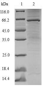 Greater than 90% as determined by SDS-PAGE.Recombinant Human Lupus La Protein (SSB) Protein (His-SUMO)