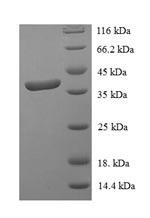 Greater than 90% as determined by SDS-PAGE.Recombinant Human Signal Transducer And Activator Of Transcription 3 (STAT3) Protein (His-SUMO)