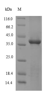Greater than 85% as determined by SDS-PAGE.Recombinant Mouse Sulfotransferase 1A1 (SULT1A1) Protein (His&Myc)