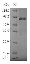 Greater than 90% as determined by SDS-PAGE.Recombinant Human Sulfotransferase 1A3 (SULT1A3) Protein (GST)