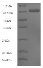 Greater than 90% as determined by SDS-PAGE.Recombinant Human Sulfite Oxidase, Mitochondrial (SUOX) Protein (His-SUMO)