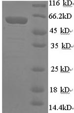 Greater than 90% as determined by SDS-PAGE.Recombinant Human Synapsin-1 (SYN1) Protein (GST)