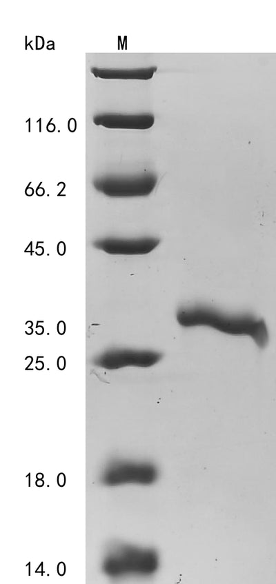 Greater than 90% as determined by SDS-PAGE.Recombinant Human Transgelin-2 (TAGLN2) Protein (His)