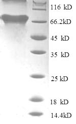 Greater than 90% as determined by SDS-PAGE.Recombinant Human Tar Dna-Binding Protein 43 (TARDBP) Protein (GST)