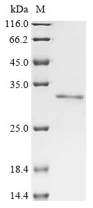 Greater than 90% as determined by SDS-PAGE.Recombinant Human Elongin-A3 Member D (ELOA3DP) Protein (His&Myc)