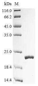 Greater than 90% as determined by SDS-PAGE.Recombinant Mouse T-Cell Leukemia/Lymphoma Protein 1A (TCL1A) Protein (His&Myc)
