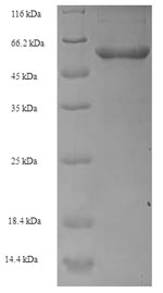Greater than 90% as determined by SDS-PAGE.Recombinant Human Transcobalamin-1 (TCN1) Protein (His-SUMO)