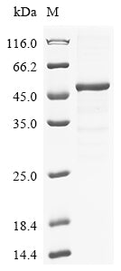 Greater than 85% as determined by SDS-PAGE.Recombinant Human Transcobalamin-2 (TCN2) Protein (His-GST)