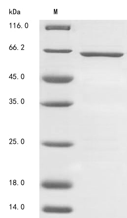 Greater than 85% as determined by SDS-PAGE.Recombinant Human Tryptophan 2,3-Dioxygenase (TDO2) Protein (His-SUMO)