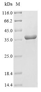 Greater than 85% as determined by SDS-PAGE.Recombinant Mouse Beta-Tectorin (TECTB) Protein (His-B2M-JD&Myc)