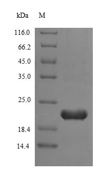 Greater than 85% as determined by SDS-PAGE.Recombinant Human Telomerase Reverse Transcriptase (TERT) Protein (His)