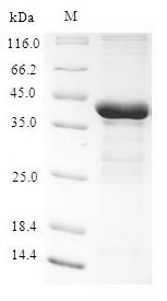 Greater than 90% as determined by SDS-PAGE.Recombinant Human Tescalcin (TESC) Protein (His-SUMO)