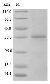 Greater than 85% as determined by SDS-PAGE.Recombinant Rat Transforming Growth Factor Beta-1 Proprotein (TGFB1) Protein (His)