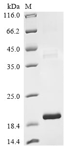 Greater than 90% as determined by SDS-PAGE.Recombinant Bovine Transforming Growth Factor Beta-2 Proprotein (TGFB2) Protein (His&Myc)