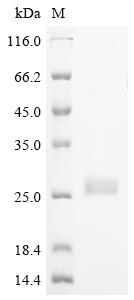 Greater than 90% as determined by SDS-PAGE.Recombinant Human Tgf-Beta Receptor Type-2 (TGFBR2) Protein (His&Myc)