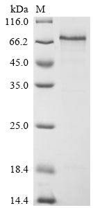 Greater than 85% as determined by SDS-PAGE.Recombinant Human Thrombomodulin (THBD) Protein (His-SUMO)