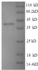 Greater than 90% as determined by SDS-PAGE.Recombinant Mouse Thrombospondin-1 (THBS1) Protein (His)