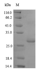 Greater than 90% as determined by SDS-PAGE.Recombinant Mouse Thrombospondin-2 (THBS2) Protein (His)