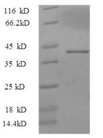 Greater than 90% as determined by SDS-PAGE.Recombinant Mouse Thrombospondin-3 (THBS3) Protein (GST)