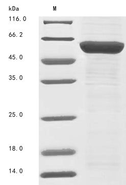 Greater than 85% as determined by SDS-PAGE.Recombinant Human Thyroid Hormone Receptor Alpha (THRA) Protein (His)