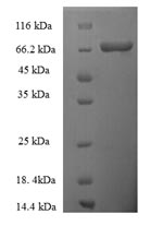 Greater than 90% as determined by SDS-PAGE.Recombinant Human Thyroid Hormone Receptor Beta (THRB) Protein (His-SUMO)