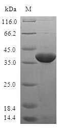Greater than 90% as determined by SDS-PAGE.Recombinant Human Tgfb1-Induced Anti-Apoptotic Factor 1 (TIAF1) Protein (GST)