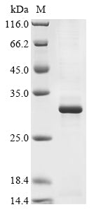 Greater than 85% as determined by SDS-PAGE.Recombinant Mouse Metalloproteinase Inhibitor 3 (TIMP3) Protein (His&Myc)