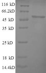 Greater than 90% as determined by SDS-PAGE.