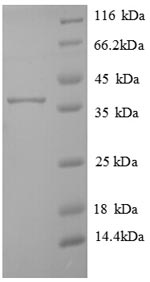 Greater than 90% as determined by SDS-PAGE.Recombinant Human Transmembrane Protein 14B (TMEM14B) Protein (GST)