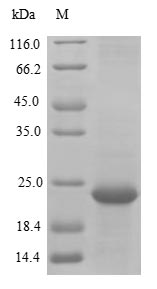Greater than 85% as determined by SDS-PAGE.Recombinant Pongo Abelii Transmembrane Protein 168 (TMEM168) Protein (His&Myc)