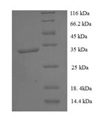 Greater than 90% as determined by SDS-PAGE.Recombinant Human Transmembrane Protein 44 (TMEM44) Protein (His-SUMO)