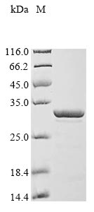 Greater than 90% as determined by SDS-PAGE.Recombinant Human Thymosin Beta-10 (TMSB10) Protein (GST)