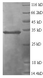 Greater than 90% as determined by SDS-PAGE.Recombinant Human Tumor Necrosis Factor-Inducible Gene 6 Protein (TNFAIP6) Protein (His)