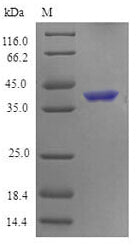 Greater than 90% as determined by SDS-PAGE.Recombinant Mouse Tumor Necrosis Factor Receptor Superfamily Member 4 (TNFRSF4) Protein (His-SUMO)