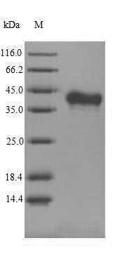 Greater than 90% as determined by SDS-PAGE.Recombinant Mouse Tumor Necrosis Factor Ligand Superfamily Member 11 (TNFSF11) Protein (His-SUMO)