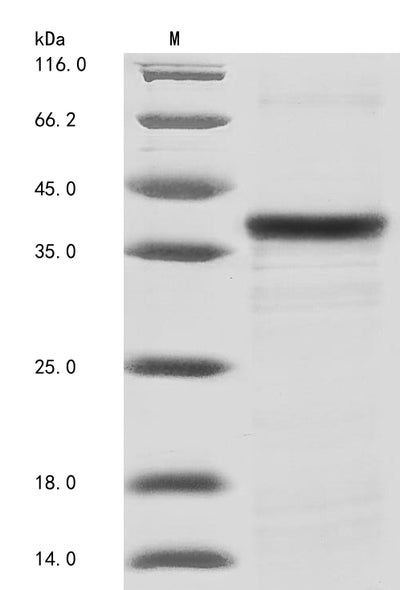 Greater than 85% as determined by SDS-PAGE.Recombinant Mouse Tenomodulin (TNMD) Protein (His)