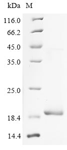Greater than 90% as determined by SDS-PAGE.Recombinant Human Troponin C, Slow Skeletal And Cardiac Muscles (TNNC1) Protein (His)