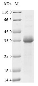 Greater than 85% as determined by SDS-PAGE.Recombinant Mouse Troponin I, Fast Skeletal Muscle (TNNI2) Protein (His&Myc)