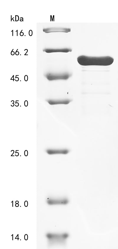 Greater than 90% as determined by SDS-PAGE.Recombinant Mouse Troponin T, Cardiac Muscle (TNNT2) Protein (His&Myc)