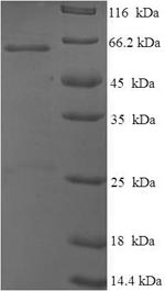 Greater than 90% as determined by SDS-PAGE.Recombinant Mouse Cellular Tumor Antigen P53 (TP53) Protein (His-SUMO)