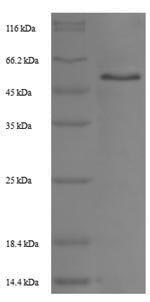 Greater than 90% as determined by SDS-PAGE.Recombinant Rat Trophoblast Glycoprotein (TPBG) Protein (His-SUMO)