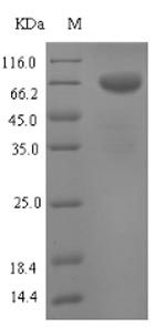 Greater than 90% as determined by SDS-PAGE.Recombinant Mouse Tryptophan 5-Hydroxylase 1 (TPH1) Protein (His-SUMO)