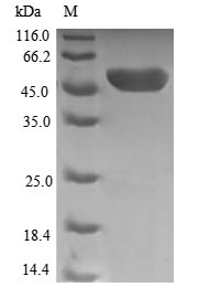 Greater than 90% as determined by SDS-PAGE.Recombinant Human Thiamin Pyrophosphokinase 1 (TPK1) Protein (GST)