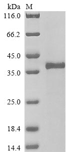 Greater than 90% as determined by SDS-PAGE.Recombinant Human Tripeptidyl-Peptidase 2 (TPP2) Protein (His&Myc)