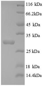 Greater than 90% as determined by SDS-PAGE.Recombinant Mouse Tryptase (TPSAB1) Protein (His)