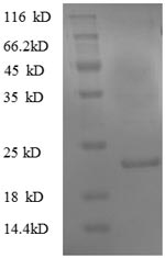 Greater than 90% as determined by SDS-PAGE.Recombinant Mouse Translationally-Controlled Tumor Protein (TPT1) Protein (His)
